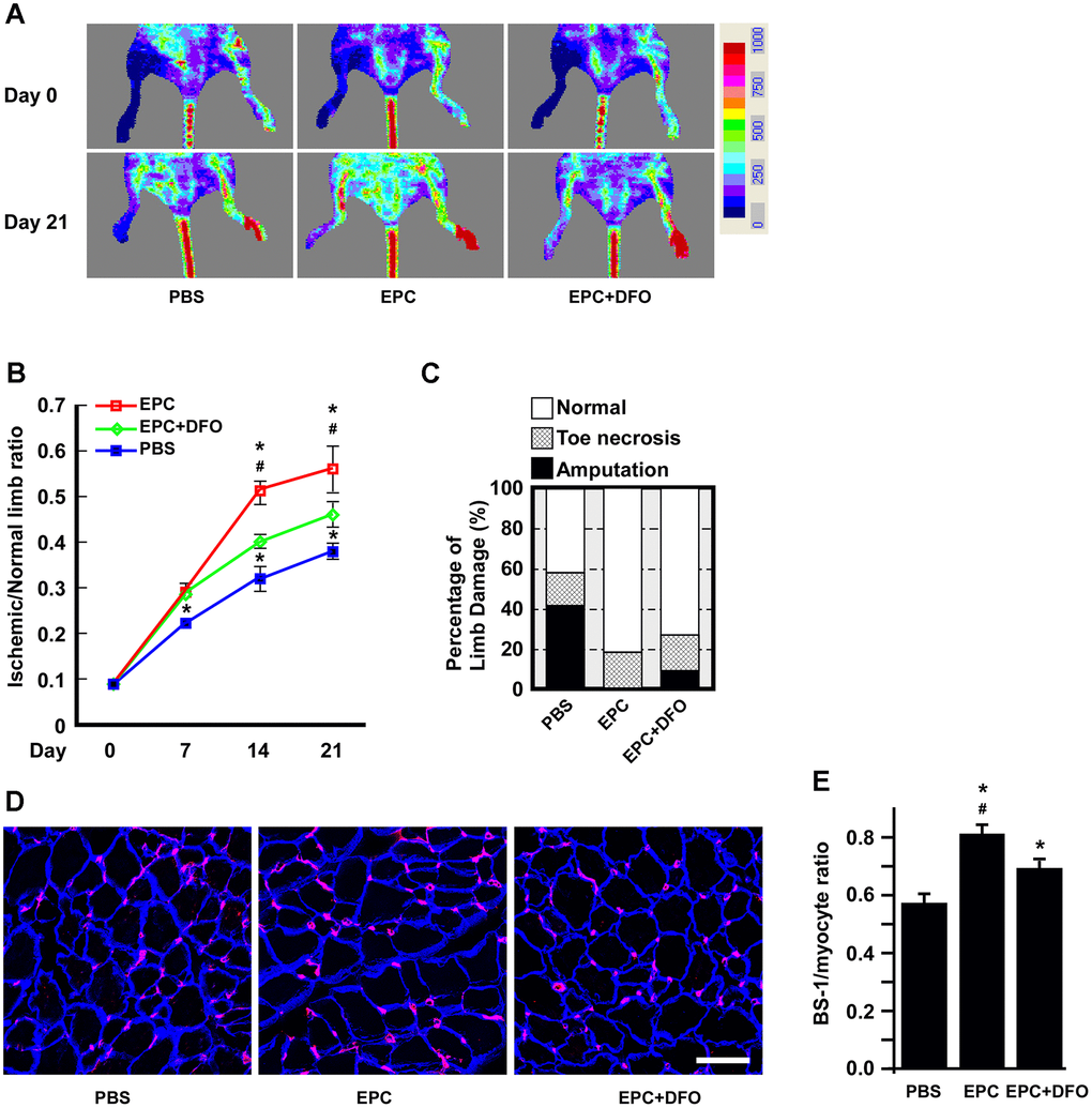 The angiogenic activity of DFO-pretreated EPCs is compromised in hind-limb ischemic animals. (A) Laser Doppler perfusion images of hind-limb ischemic rats injected with human EPCs to test their angiogenic activity. The rats were imaged on day 0 and day 21 after being injected with PBS, EPCs or EPCs treated with 10 μM DFO for four days. PBS without EPCs served as a mock injection, while untreated right hind limbs served as the control. (B) Quantification of the ischemic area versus the normal perfusion area. The days on which the images were captured are indicated. * P C) Damaged tissues were rescued through the injection of young EPCs but not DFO-treated EPCs. The degree of tissue damage was classified into three categories: normal (n=10, empty box), toe necrosis (n=11, grid box) or amputation (n=11, filled box). The percentage of amputated limbs was 10% higher in the DFO-treated EPC group (EPC+DFO) than in the EPC-injected group. (D) Representative images of staining for myocytes and capillaries. On day 21, tissues were sectioned and stained with laminin (blue) and Bandeiraea simplicifolia lectin 1 (BS-I, red) to visualize myocytes and capillaries, respectively. Due to tissue atrophy, the peripheries of the PBS-treated myocytes appeared to be smaller than those of the EPC-injected myocytes. (E) Quantification of capillary density, which was calculated as the number of capillaries divided by the number of myocytes. * P 