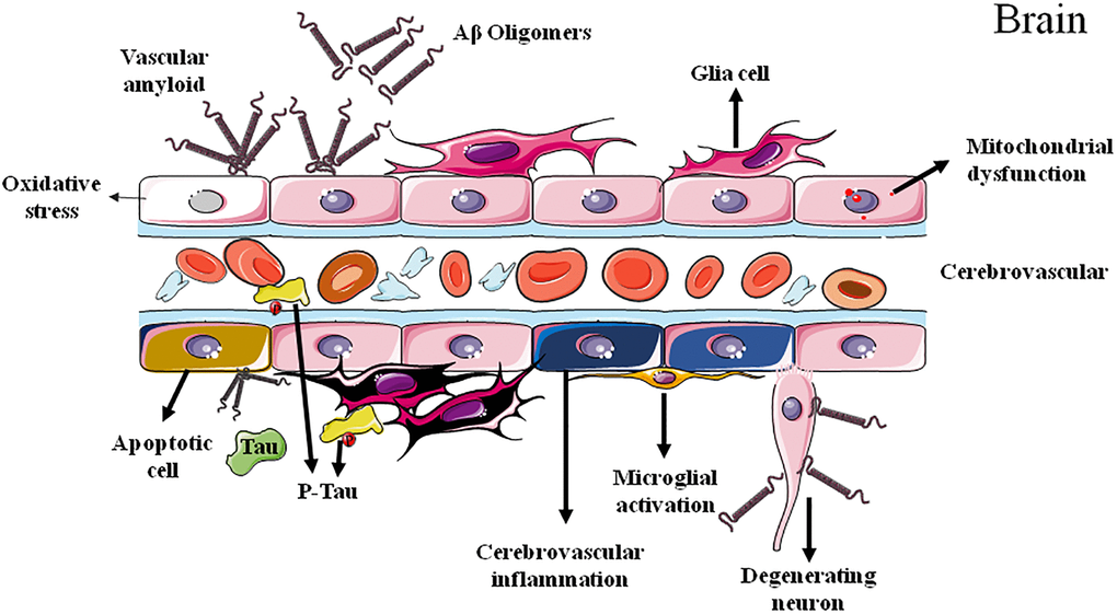 Cerebrovascular dysfunctions in Alzheimer's disease.