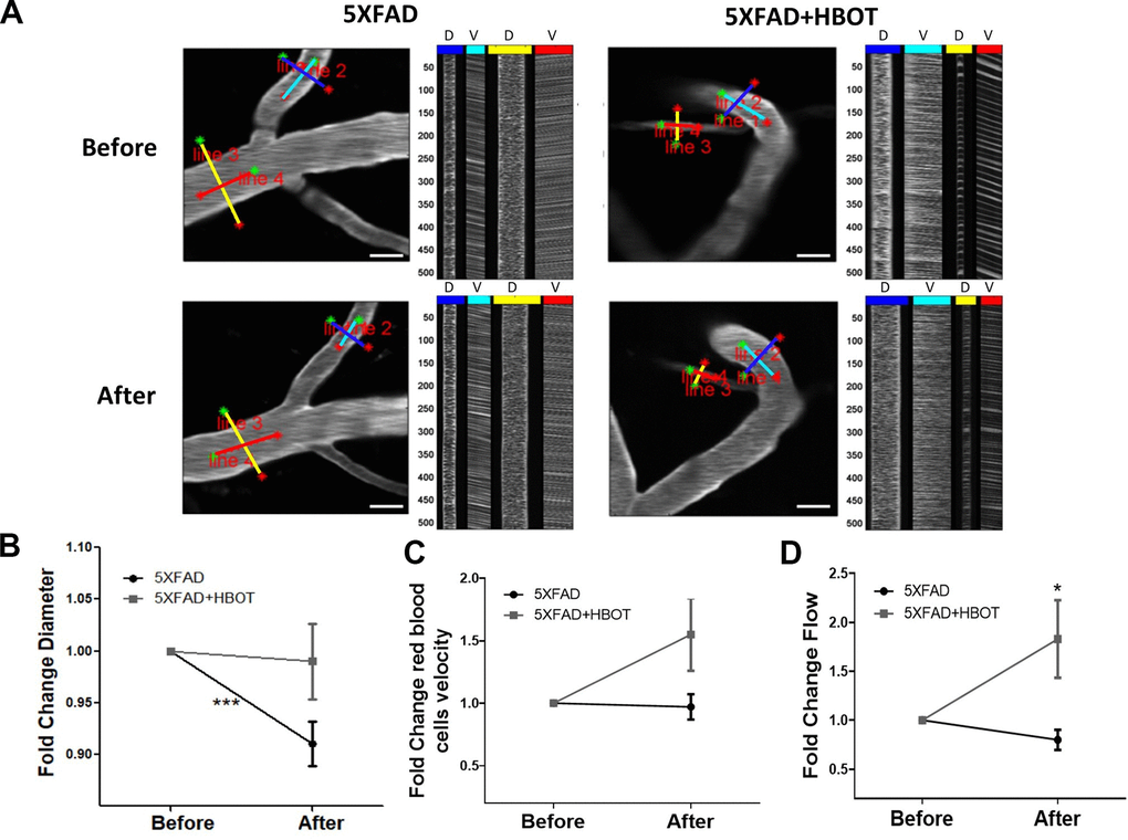 HBOT alleviates the reduction in vessel diameter in 5XFAD mice and increases blood flux.In vivo two-photon microscopy imaging and measurements of diameter and velocity in blood vessels of the somatosensory cortex in 5XFAD mice using spatially optimized line scans. (A) Representative images of fluorescently stained vessels of the somatosensory cortex of an HBO-treated 5XFAD mouse (right panel) and a control 5XFAD mouse (left panel) before (upper panel) and after a month of treatment (lower panel). Line scan patterns are superimposed on the vessels. Lines of the scan path along the length were used to calculate RBC velocity (V), while lines across the diameter of the vessels were used to calculate diameter (D). The line scans generated from the path can be stacked sequentially as a function of time to produce a raw cascade image (right of each image). Vessel diameter was calculated as the full width at half-maximum of a time average of several scans across the width of a vessel. RBC velocity was calculated from the angle of the RBC streaks. (B–D) Quantification of vessel diameter (B), RBC velocity in the blood vessels (C) and RBC flow (D), normalized to each treatment group baseline value. Paired t-tests and student t-tests were performed. Values represent means ± SEM.* P P 