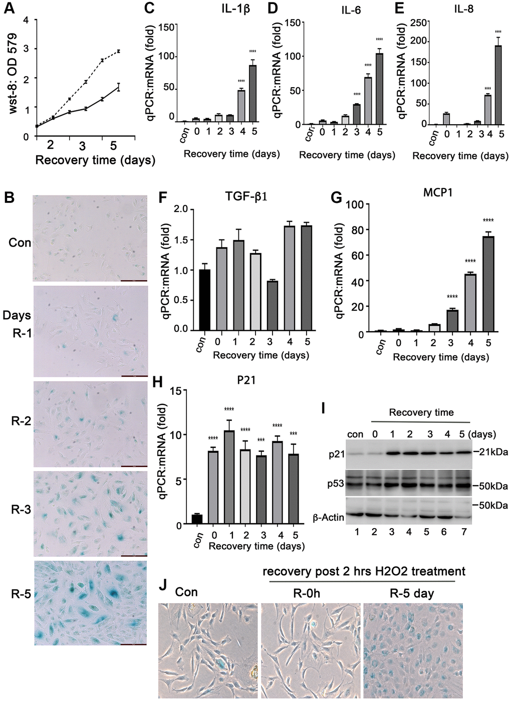 Induction of senescent ARPE-19 cells by H2O2in vitro. (A) Proliferation of ARPE-19 during recovery after 2 hours of H2O2 treatment using the CCK-8 assay (WST-8, 2-methoxy-4-nitrophenyl)-3- (4-nitrophenyl)-5- (2, 4-disulfophenyl)-2H-tetrazolium). (B) Staining for SA-β-Gal activity in ARPE-19 cells treated with 200 μM H2O2 for 2 hours followed by recovery for 1, 2, 3, 4 and 5 days. (C–H) Quantitative PCR to detect mRNA expression of IL-1β, IL-6, IL-8, MCP-1, TGF-β1 and P21 in ARPE-19 cells treated with H2O2 in the same way as in B. (I) Immunoblot of P53 and p21 protein expression in ARPE-19 cells treated with H2O2 in the same way as in B. (J) Detection of SA-β-Gal activity in passage 3 primary monkey RPE cells treated with H2O2 for two hours followed by recovery in normal media for 0 and 5 days. The two-tailed unpaired t-test was used for statistical analysis. The data were collected from three independent experiments (n = 3).