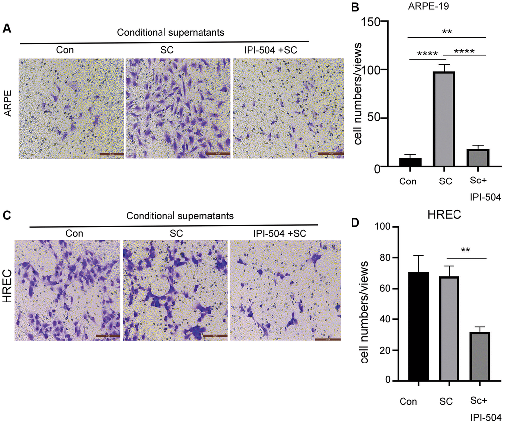 IPI-504 inhibit senescent ARPE-19 cells-mediated cell migration. (A) Transwell assay. The chamber with ARPE-19 cells were incubated in wells containing the conditional media from proliferating ARPE-19 cells, day-4 senescent ARPE-19 cells and day 4-senescent ARPE-19 cells that were pretreated with IPI-504 for 24 hours. The migrated cells at bottom were photographed. (B) The quantitation of migrated cell numbers in A. (C) Transwell assay. The chamber with HREC cells were incubated in wells that contains the conditional media used in A. The migrated cells at bottom were photographed. (D) The quantitation of migrated cell numbers in C. The two-tailed unpaired t-test was used for statistical analysis (n = 4).