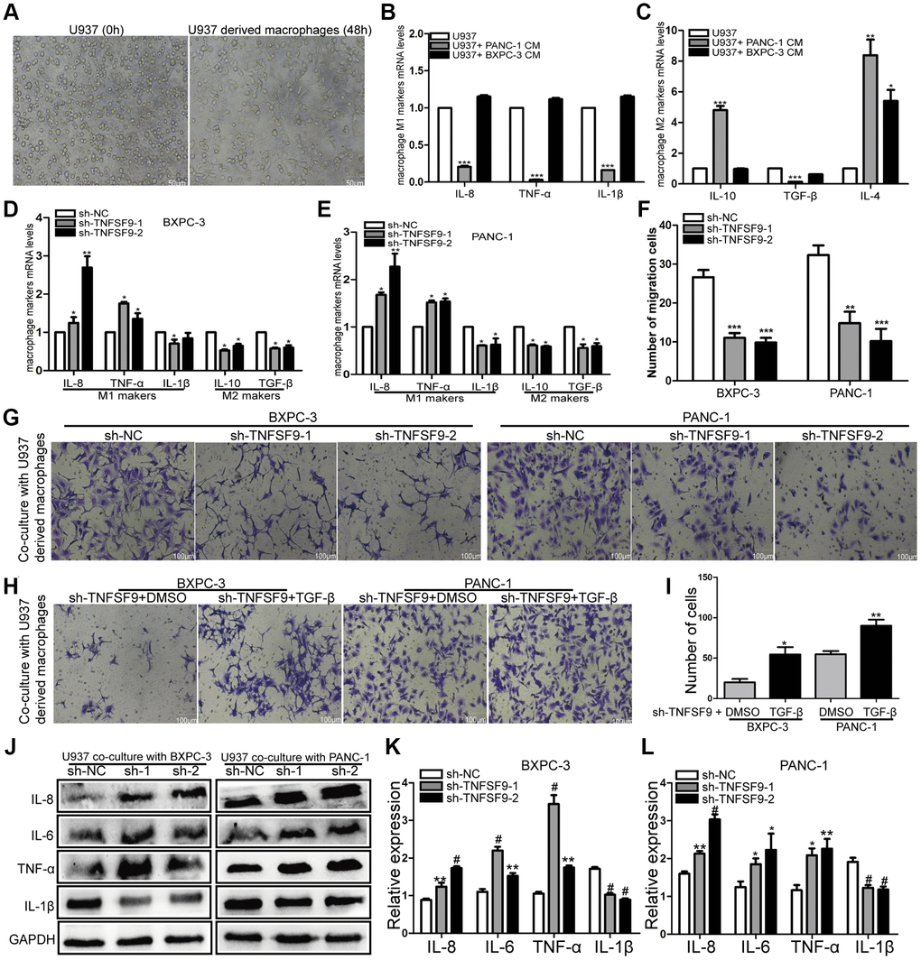 TNFSF9 induces M2 polarization of macrophages and promotes the migration of pancreatic cancer cells. (A) U937 cells were successfully induced into macrophages. (B, C) The effect of wild-type pancreatic cancer cells on the polarization of U937-derived macrophages. (D, E) TNFSF9 knockdown pancreatic cancer cells inhibit the expression of M2 markers (IL-10 and TGF-β) mRNA levels in U937 macrophages. At the same time, it promotes the expression of M1 marker (IL-8 and TNF-α) mRNA level and inhibits the expression of IL-1β mRNA level. (F, G) Co-culture of U937-derived macrophages with TNFSF9 knockdown pancreatic cancer cells inhibited the migration of BXPC-3 and PANC-1 cells. (H, I) The migration of BXPC-3 and PANC-1 cells increased after adding recombinant human protein TGF-β. (J–L) Western blots were used to analyze the expression of inflammatory cytokines IL-8, IL-6, TNF-α and IL-1β on U937-derived macrophages after co-culture with pancreatic cancer cells knocked down by TNFSF9. Compared with the sh-NC group, the expression of IL-8, IL-6 and TNF-α in the sh-TNFSF9-1 and sh-TNFSF9-2 groups were significantly increased, and the expression of IL-1β was significantly reduced. sh-1 is sh-TNFSF9-1. sh-2 is sh-TNFSF9-2. *P **P ***P #P 