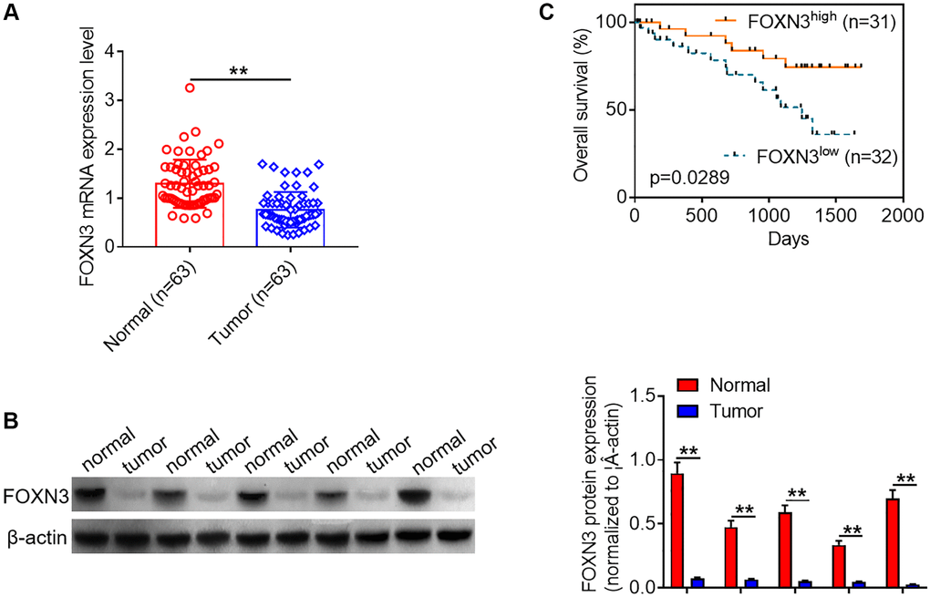 Decreased FOXN3 expression is observed in glioma tissues. (A) FOXN3 mRNA expression levels in clinical tissue samples were determined via qPCR analysis. (B) FOXN3 protein expression levels in clinical tissue samples were examined using Western blotting. (C) Glioma patients were divided into high FOXN3 expression group and low FOXN3 expression group based on the median of its expression levels in cancerous tissues. Kaplan-Meier survival curve was used to analyze the correlation between FOXN3 mRNA expression level and overall survival time. **P 