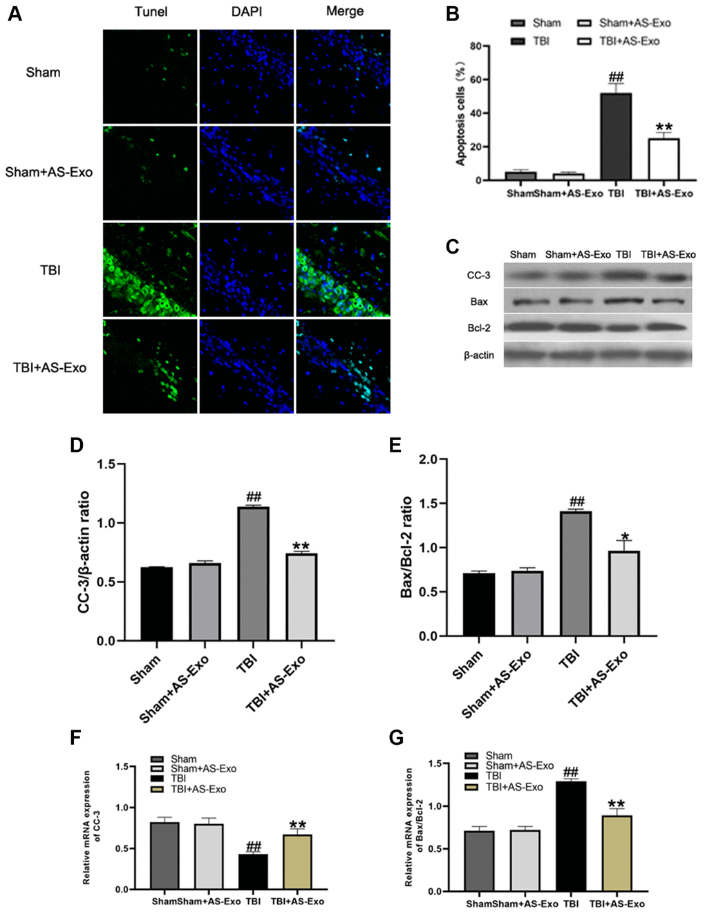 AS-Exos reduce TBI-induced neuronal apoptosis. (A) Representative confocal images (scale bar, 50 μm) show neuronal apoptosis in hippocampus tissues from TBI+AS-Exo, Sham, and Sham+AS-Exo groups of rats at 48 h after TBI or sham surgery based on TUNEL (green) and DAPI (blue) staining. (B) Bar graph shows the relative percentage of apoptotic neuronal cells in the hippocampus tissues based on TUNEL staining from the four groups of rats at 48 h after TBI or sham surgery. (C) Western blot analysis shows expression levels of CC-3 Bax, and Bcl-2 proteins in the hippocampus tissues from TBI+AS-Exo, Sham, and Sham+AS-Exo groups of rats at 48 h following TBI or Sham surgery. (D–E) Bar graphs illustrate densitometry analyses of (D) CC-3 and (E) Bax/Bcl-2 ratio. The protein bands were normalized to β-actin. (F–G) Bar graphs illustrate qRT-PCR results for the expression levels of (F) CC-3 and (G) Bax/Bcl-2 mRNAs relative to β-actin in hippocampus tissues from TBI+AS-Exo, Sham, and Sham+AS-Exo groups of rats at 48 h after TBI or sham surgery. All data are represented as means ± SEM (n = 5 per group). Statistical significance was determined using one-way ANOVA followed by post-hoc Bonferroni correction. #P ##P *P **P 