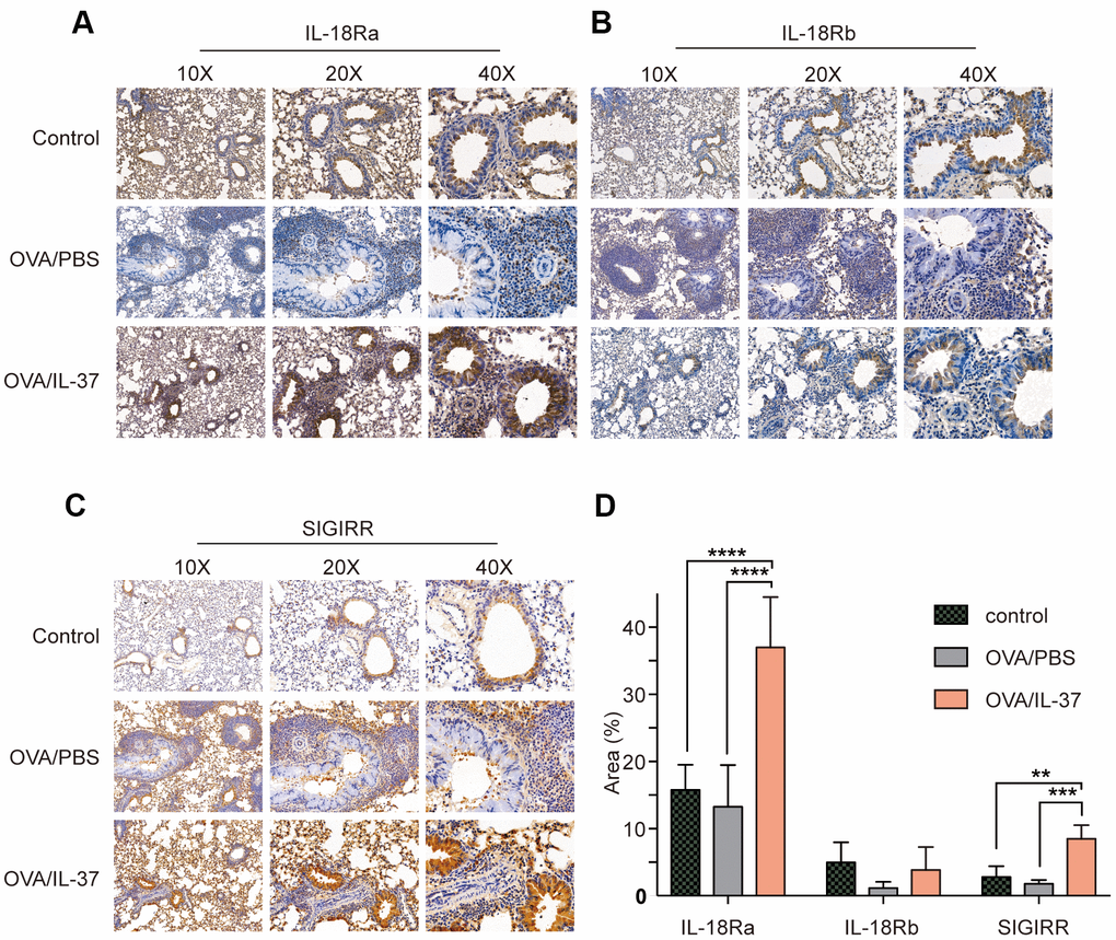 Immunohistochemistry detection of IL-18Ra, IL-18Rb, SIGIRR in mice lung tissue from PBS, OVA/PBS, OVA/rhIL-37 group (n=10 mice per group). Representative photomicrographs of immunohistochemistry staining for IL-18Ra (A), IL-18Rb (B) and SIGIRR (C) in mice lung tissue from each group. (D) Quantitation of IL-18Ra, IL-18Rb, SIGIRR expression. IL-18Ra and SIGIRR expression in the lung tissue of the OVA/IL-37 group was significantly upregulated compared to the OVA/PBS group, while the difference of IL-18Rb expression in the lung tissue of the OVA/IL-37 group was not statistically significant upregulated compared to the OVA/PBS group. Columns and error bars represented mean±SEM. n=10 per group. **p