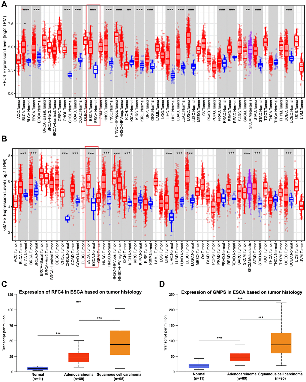 RFC4 and GMPS were upregulated in most cancers, especially ESCC. (A) Pan-cancer analysis of RFC4. (B) Pan-cancer analysis of GMPS. (C) Expression of RFC4 in patients with esophageal carcinoma based on histology. (D) Expression of GMPS in patients with esophageal carcinoma based on histology. *p **p ***p 