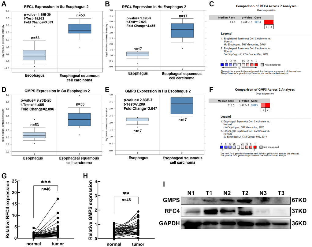 Expression analysis of RFC4 and GMPS in ESCC. (A) RFC4 mRNA levels in Su Esophagus 2. (B) RFC4 mRNA levels in Hu Esophagus 2. (C) Comparison of RFC4 across Su and Hu Esophagus. (D) GMPS mRNA levels in Su Esophagus 2. (E) GMPS mRNA levels in Hu Esophagus 2. (F) Comparison of GMPS across Su and Hu Esophagus. (G, H) RFC4 and GMPS mRNA levels were detected by RT-qPCR in 46 pairs of ESCC and adjacent normal tissues. (I) Protein levels in the three pairs of tissues. *p **p ***p 