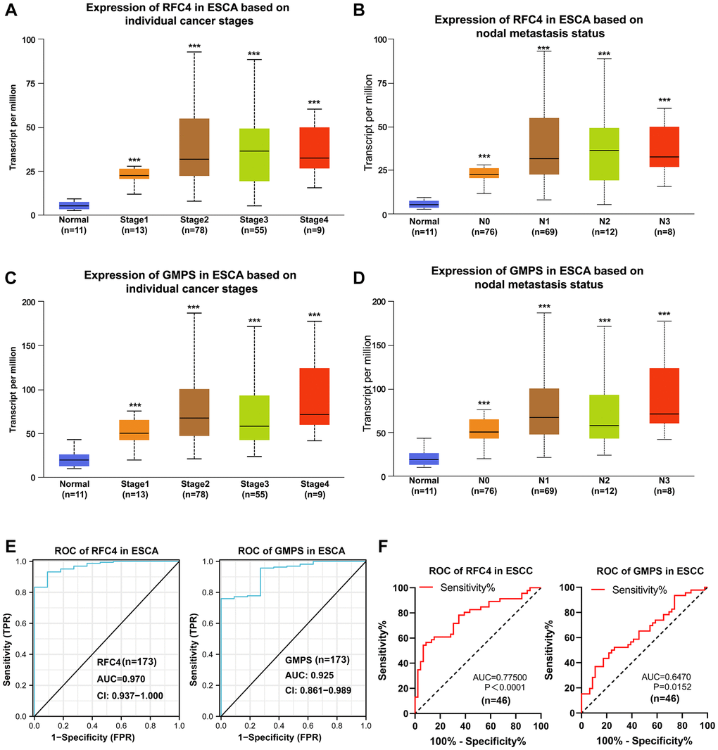 Upregulated RFC4 and GMPS are associated with the early diagnosis of esophageal carcinoma and may be the biomarkers for the early diagnosis of esophageal carcinoma. (A, B) Expression of RFC4 in patients with esophageal carcinoma based on the stage and nodal metastasis. (C, D) Expression of GMPS in patients with esophageal carcinoma based on the stage and nodal metastasis. (E) Receiver operating characteristic (ROC) curve analysis of RFC4 and GMPS in esophageal carcinoma (n = 173). (F) Receiver operating characteristic (ROC) curve analysis of RFC4 and GMPS in ESCC (n = 46). *p **p ***p 