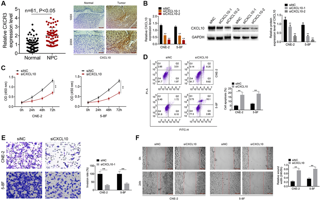 Knockdown of CXCL10 inhibited cell proliferation and invasion of NPC cells. (A) The expression of CXCR3 was examined by qRT-PCR assay. The expression of CXCL10 in NPC tumor tissue and normal tissue was examined by IHC analysis. (B) CNE-2 and 5–8F cells were transfected with siNC, siCXCL10-1 or siCXCL10-2, and RT-PCR was performed to examine the CXCL10 expression. (C) Cell proliferation of CNE-2 and 5–8F cells was identified by CCK8 assay. (D) Cell apoptosis of CNE-2 and 5–8F cells was evaluated by FCM. (E) Cell invasion was tested by wound healing assay. (F) Cell migration was detected by Transwell assay. **P 