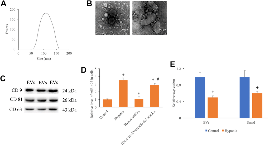 Identification of EVs and measurement of miR-497 in the hypoxia cells. (A) The size distribution of EVs; (B) Morphology of EVs measured by an electron microscope; (C) Specific markers of EVs were measured using western blotting; (D) The mRNA level of miR-497 was measured after different treatments; (E) The levels of EVs and Smad7 were significantly suppressed after hypoxia treatment. + indicated P