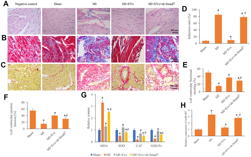 Knockdown of Smad7 reversed the improvement of cardiac function induced by EVs. (A) Influence of EVs and sh-Smad7 on the histological changes of MI animals; (B) Collagen deposition was investigated using Masson trichrome staining; (C) Collagen deposition was investigated using sirius red staining; (D) Influence of EVs and sh-Smad7 on infarction was analyzed; (E) Influence of EVs and sh-Smad7 on left ventricular fractional shortening was analyzed; (F) Influence of EVs and sh-Smad7 on left ventricular ejection fraction was analyzed; (G) Influence of EVs and sh-Smad7 on MDA, SOD, CAT, and GSH-Px was analyzed; (H) sh-Smad7 reversed the influence of EVs on the expression of miR497. + indicated P