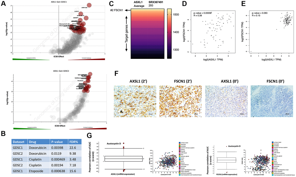 Expressions of ASXL1 and FSCN1 was positively correlated. Reproduced from the GDSC dataset, shown were volcano plots of drug sensitivity of gain of cytoband encompassing ASXL1 in pan-cancer cell lines from (A) GDSC1 and GDSC2 repositories and (B) retrieved P values for Doxorubicin, Etoposide and Cisplatin; (C) Reproduced from ChIP-Atlas, shown was heatmap ranked by binding score of ASXL1 from high to low in different model cells (human 293 cells), each row representing one gene; (D) Reproduced from the TCGA adrenocortical carcinoma (ACC) dataset, shown was expression correlation between ASXL1 and FSCN1 in ACC samples; (E) Reproduced from the GTEx dataset, shown was expression correlation between ASXL1 and FSCN1 in normal adrenal samples; (F) Representative IHC image of ASXL1 and FSCN1 staining in ACC samples with numbers indicating IHC score; (G) Reproduced from The Cancer Therapeutics Response Portal, shown were box plots of correlation coefficients between area under control and gene expression in cancer cells.