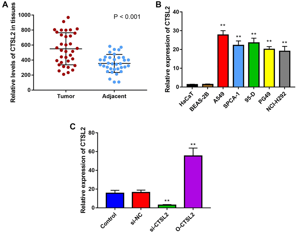 CTSL2 expression in human LUAD tissues and cell lines. (A) Expression of CTSL2 in 35 LUAD tissues and adjacent normal tissues by qRT-PCR; (B) CTSL2 expression levels in HaCaT, BEAS-2B, A549, SPCA-1, 95-D, PG-49, and NCI-H292 by qRT-PCR; (C) CTSL2 expression in A549 cells transfected with control, si-NC, si-CTSL2, and O-CTSL2 by qRT-PCR. **P 