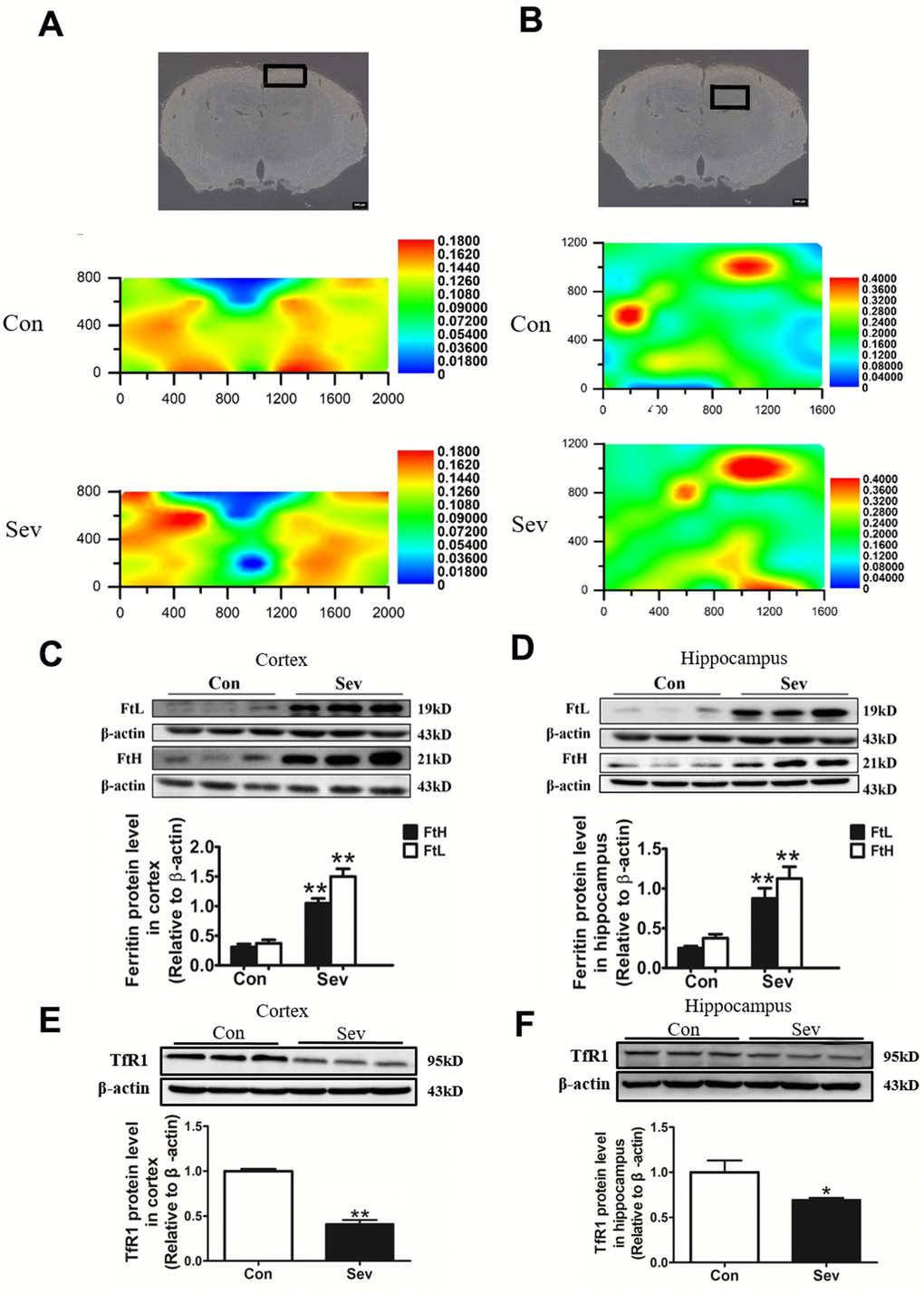 Effect of Sev on the levels of brain iron and the expression of iron metabolism-related proteins in elder mice. The mice were treated with Sev as described in Materials and Methods. (A, B) showed the iron levels of cortex and hippocampus of mice between control group and Sev group (The larger the red area, the greater the iron content). (C–F) showed the effect of Sev on the expression of FtL, FtH, and TfR1 in cortex and hippocampus. The western blot results were calculated as the ratios ± SD (n = 5) of the FtL, FtH, and TfR1 band intensities relative to that of actin. **P 