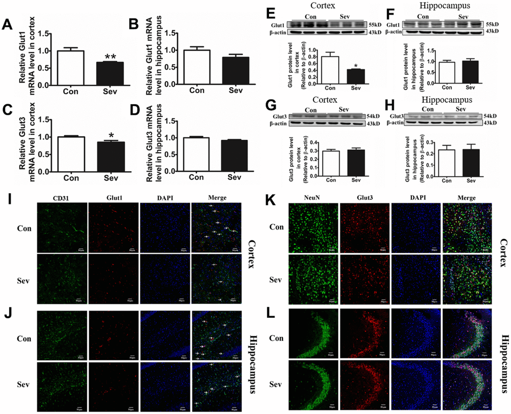 Sev inhibited the absorption of glucose by downregulating the expression of Glut1 in vascular endothelial cells, rather than glucose receptor 3 in nerve cells. Effect of Sev on the mRNA expression of Glut1 (A, B) and Glut3 (C, D) and the protein expression of Glut1 (E, F) and Glut3 (G, H) in cortex and hippocampus. (I–L) Showed the Glut1 and Glut3 expression in vascular endothelial cells and neurons of cortex and hippocampus by immunofluorescence, respectively. Data are expressed as mean±SD, n=5 (**p