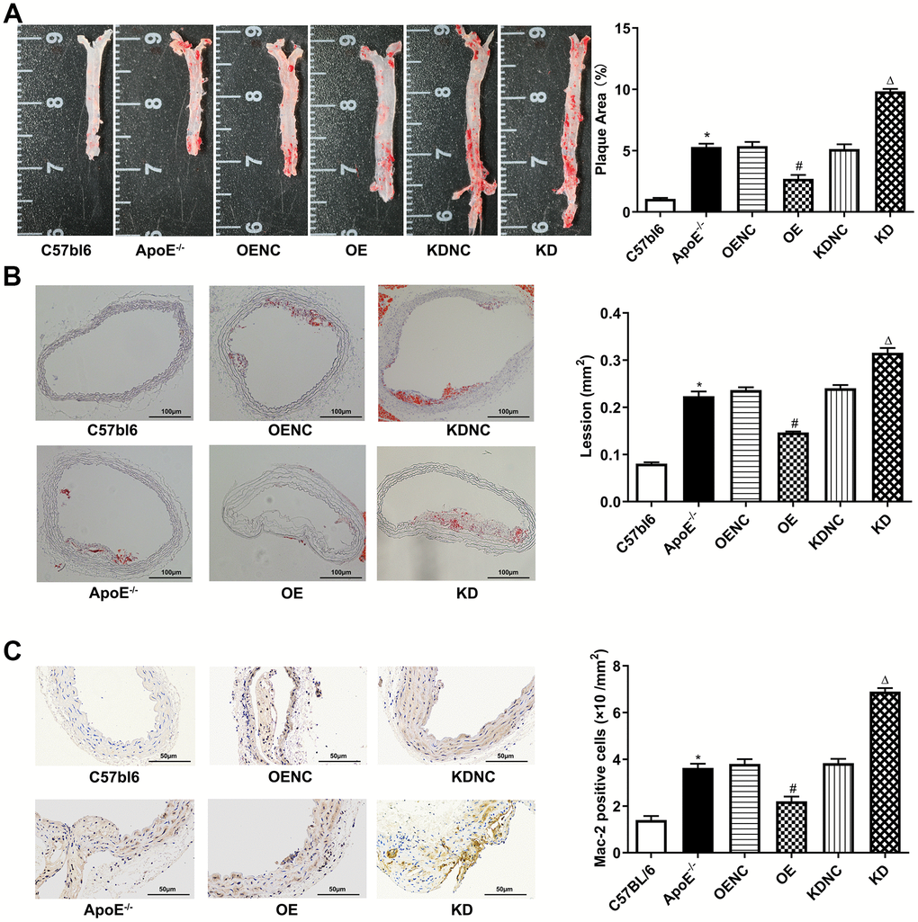 Antiatherosclerotic role of Pim-2 in atherosclerosis. Representative images of atherosclerotic lesions stained by oil red O in the whole enfaced aorta (A) and aortic root sections (B), with semiquantitative analysis on the right (n=4 per group). (C) Representative images of Mac-2 expression by immunohistochemistry in mouse aortic root sections, with semiquantitative analysis on the right (n=4 per group). *P #P ΔP 