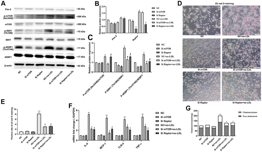 Pim-2 suppresses atherosclerotic inflammation via the mTORC1 pathway in THP-1-derived macrophages. (A) Representative western blot analysis of Pim-2, p-mTOR (Ser2448) and mTOR, p-S6K1 (Thr389) and S6K1, and p-4EBP1 (Thr37/46) and 4EBP1 in Si-mTOR- or Si-Raptor-treated ox-LDL-treated THP-1-derived macrophages after Pim-2 KD. β-Actin was used as a loading control. (B, C) Corresponding densitometric analysis of blots in (A). (D) Intracellular lipid droplets were stained with oil red O working solution in Si-mTOR- or Si-Raptor-disposed ox-LDL-treated THP-1-derived macrophages after Pim-2 KD. (E) Quantification of positive staining for lipid droplets (n=3 per group). (F) mRNA expression of inflammatory cytokines, including IL-6, MCP-1, TLR-4 and TNF-α, was determined by quantitative RT-PCR in Si-mTOR- or Si-Raptor-treated ox-LDL-treated THP-1-derived macrophages after Pim-2 KD; the values were normalized to the housekeeping gene GAPDH. (G) The concentrations of TC, FC, and CE were determined using the TC/FC Quantification Assay (n=3 per group). Data are represented as the means ± SD of three independent experiments; *P P P #P 