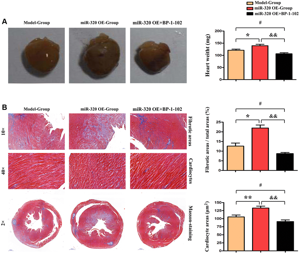 MiR-320 OE accelerated cardiac function damage with significant cardiac fibrosis. (A) The histological assessment was performed to evaluate cardiac morphology between the model, miR-320 OE, and miR-320 OE + BP-1–102 samples. (B) Representative pictures of myocardial connective tissue Masson staining demonstrate cardiac fibrosis and fibrosis area. The quantitative analysis of fibrosis area/total areas, cardiocyte areas, and heart/weight ratio. P 