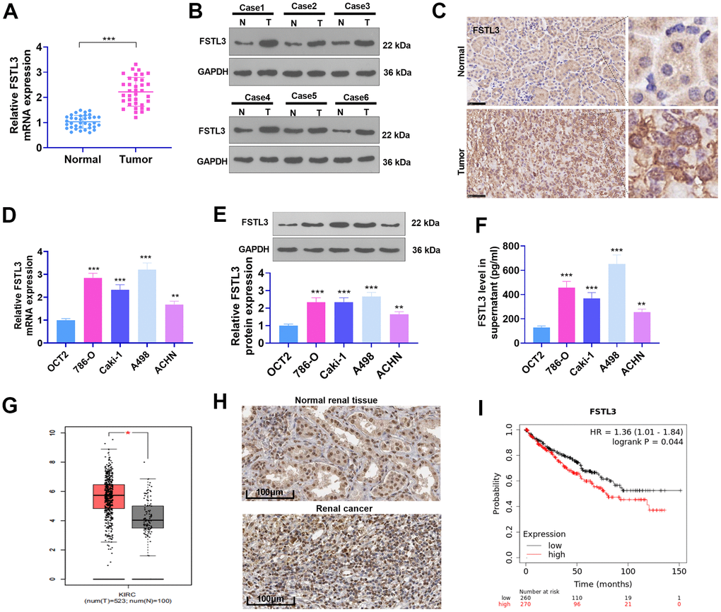 The profile of FSTL3 in RCC. (A) qRT-PCR determined FSTL3’s expression in RCC tissues as well as adjacent normal tissues, ***PB) Western blot was taken for FSTL3 profile detection in RCC tissues and adjacent normal tissues. (C) IHC ascertained FSTL3’s expression in RCC tissues and adjacent normal tissues, Bar=50 μm; (D, E) qRT-PCR (D) and Western Blot (E) examined FSTL3 in the OCT2, A498, 786-O, Caki-1, and ACHN cell lines, **PPF) ELISA measured FSTL3 in the OCT2, A498, 786-O, Caki-1, and ACHN culture mediums, **PPG) FSTL3 expression in RCC was figured out through the GEPIA database (http://gepia.cancer-pku.cn/). (H) FSTL3’s expression in RCC tissues or normal renal tissues was analyzed via Human Protein Atlas (https://www.proteinatlas.org/). (I) The Kaplan-Meier Plotter database (http://kmplot.com/analysis/index.php?p) was consulted to confirm FSTL3 expression in the survival rate of KIRC patients.
