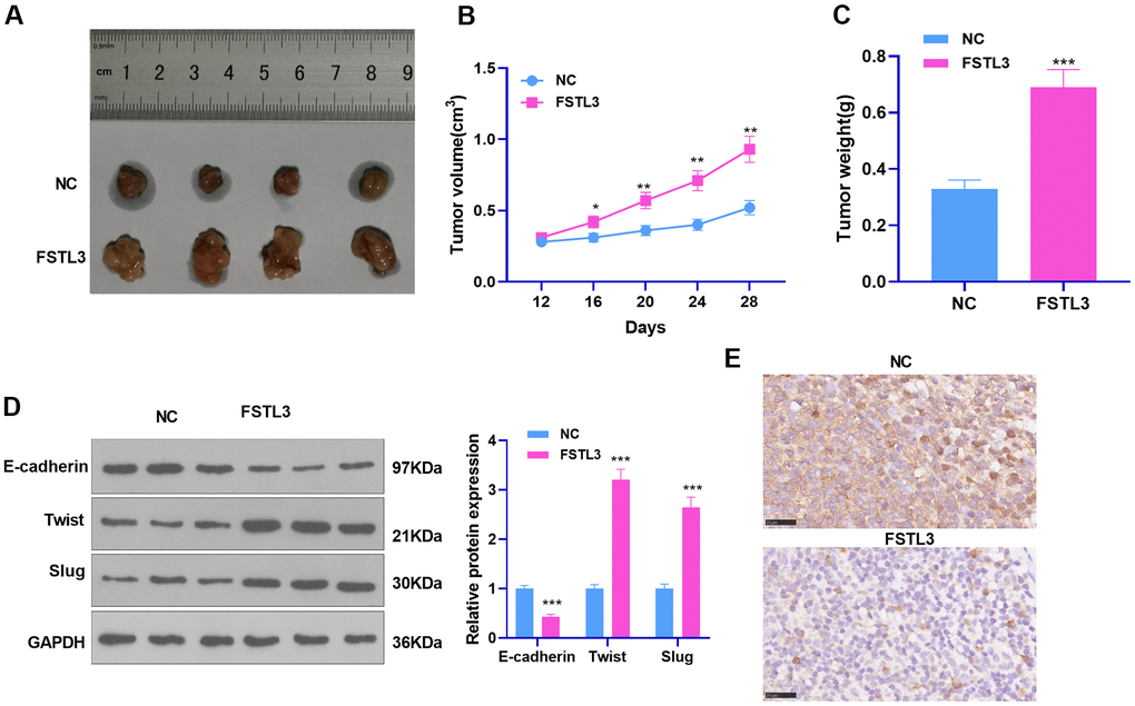 FSTL3 influenced RCC growth. ACHN cells transiently transfected along with the overexpression plasmids of FSTL3 were transfused under the skin of the experimental mice. (A–C) We observed and measured the tumor growth in mice and drew the growth curve and weighted histogram; (D) Western Blot evaluated the protein profiles of E-cadherin, Twist, and Slug. (E) IHC determined E-cadherin expression in the tumor tissues. *PPP