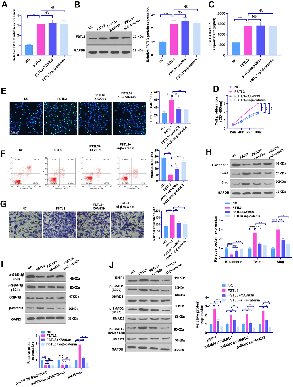 β-catenin inhibition attenuated FSTL3-induced RCC progression. FSTL3 overexpression plasmids were transfected into ACHN cells, and XAV939 (1 μM) or si-β-catenin was added for intervention post FSTL3 overexpression. (A–C) qRT-PCR (A), western blot (B), and ELISA (C) were deployed for FSTL3 detection; (D–G) CCK8 (D), BrdU (E), Flow cytometry (F), and Transwell (G) monitored cell proliferation, apoptosis, and invasion; (H–J) The protein expressions of the EMT, GSK-3β/β-catenin, and BMP1/SMAD pathways were confirmed via Western Blot. *PPP