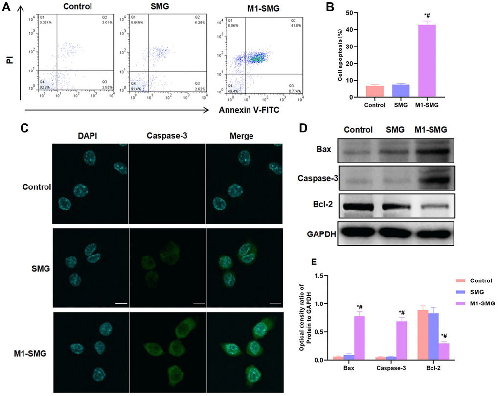 M1-SMG induced cartilage cell injury. (A–B) The results of flow cytometry showed that SMG had no obvious injury to cartilage cells, and the apoptosis rate was not significantly different from that of Control group. M1-SMG promoted apoptosis, with significantly higher apoptotic rate than that of Control and SMG groups. Comparison with Control, *P #P C) IF staining showed that there was no significant expression of Caspase-3 in Control or SMG group. The expression of Caspase-3 was up-regulated in M1-SMG, with significantly enhanced fluorescence intensity than that of SMG and Control. (D–E) Western-Blot (n = 3) Detection of protein expression showed that M1-SMG promoted the expression of apoptotic protein (Bax and Caspase-3) and inhibited the expression of Bcl-2. Comparison with Control, *P #P 