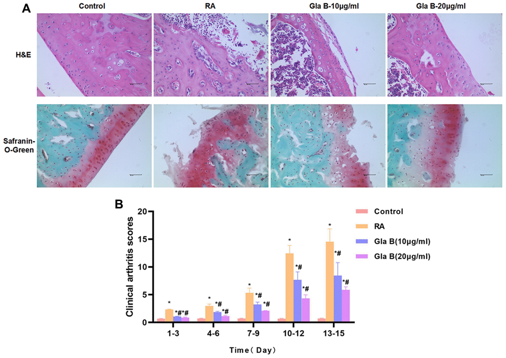 The effect of Gla B on cartilage injury in RA. (A) H and E and safranin-O-Green staining showed no obvious injury and no inflammatory response of cartilage tissue in Control mice. The cartilage tissue was severely damaged in RA mice, with obvious inflammatory response. Gla B could inhibit the cartilage injury and inhibit the inflammatory response in RA mice. (B) The clinical pathological score of RA showed that the score was low in Control group, without obvious pathological change. The score was significantly up-regulated in RA, higher than that in Control group. Gla B could decrease the pathological score. Comparison with Control, *P #P 