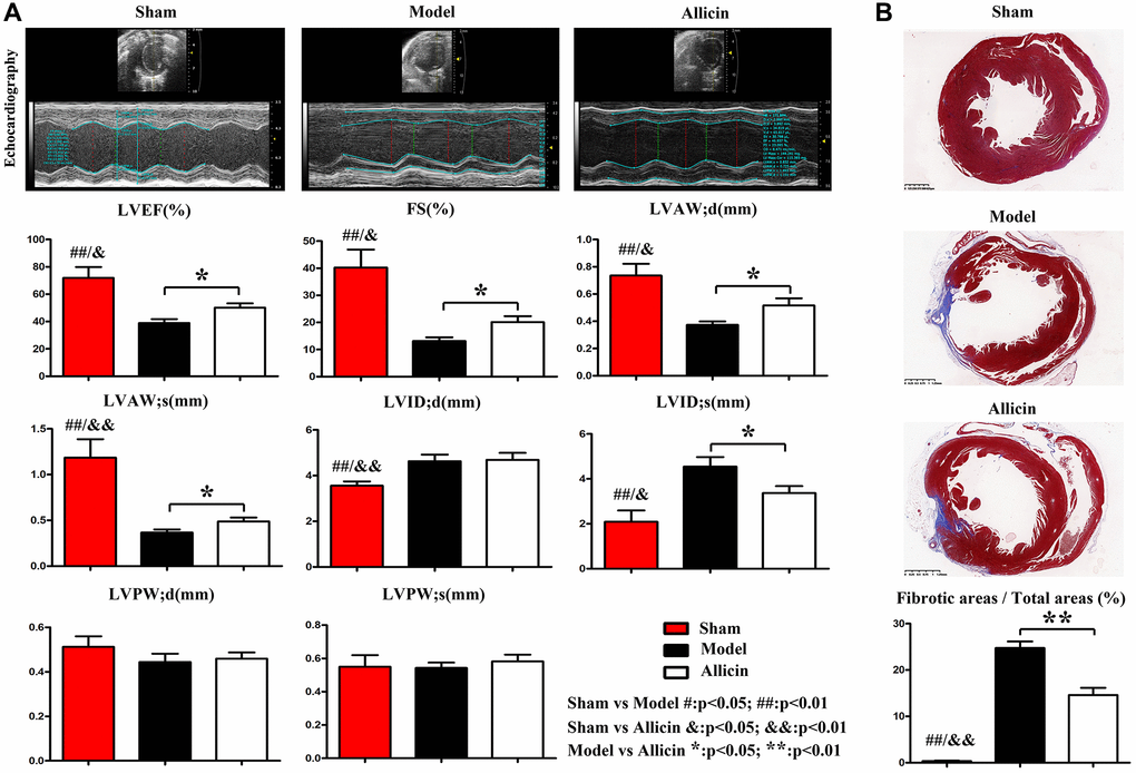 Allicin attenuated myocardial ischemia-induced cardiac fibrosis and improved cardiac function. (A) Representative images of the transabdominal ultrasound imaging were presented. Compared with the Control group, the values of LVEF, LVFS, LVAW;d and LVAW;s were significantly decreased in Model group, while LVIDd and LVIDs were increased (*P *P B) Masson staining demonstrated that the areas of cardiac fibrosis of the Model group mice were significantly increased compared with the Control group mice's hearts. And the areas of cardiac fibrosis of the Model group mice were significantly increased compared with Allicin group mice (*P 