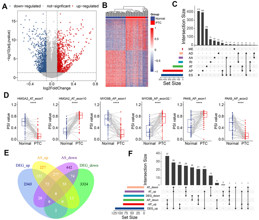 Identification of CASEs in PTC. (A) Volcano plot of CASEs identified in PTC (log2FC > 0.1, adjusted P B) Heatmap of the CASEs between matched tumor and adjacent normal tissues of 50 PTC patients. (C) Interactive sets among seven AS types of CASEs (n = 1,925) shown in an UpSet plot. (D) The representative CASEs, derived from the same parent gene and exhibited the opposite preference between tumor and adjacent normal tissues, were shown. Student’s t-test was used. (E) Venn diagram of CASEs and DEGs. (F) Interactive sets of AP/AT events and DEGs shown in UpSet plot. ES, exon skipping; AP, alternate promoter; AT, alternate terminator; AD, alternate donor; AA, alternate acceptor site; ME, mutually exclusive exons; RI, retained intron.