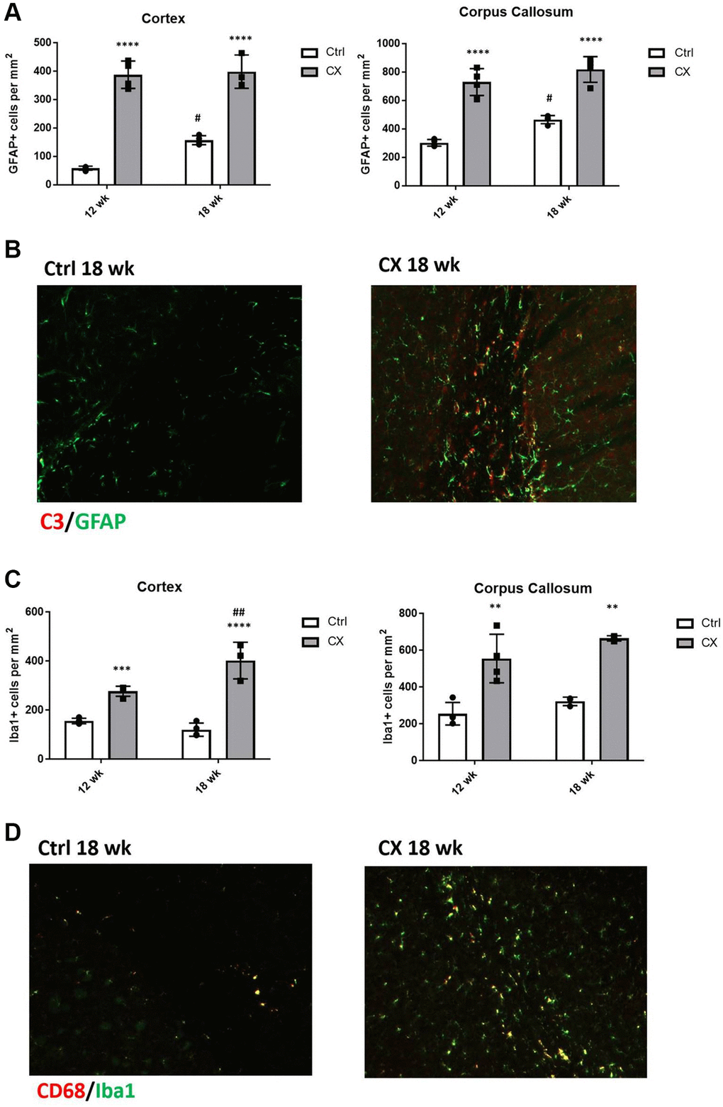 CX mice display astrocyte and microglia activation in the brain. (A) Reactive astrocytes number increase in CX brain cortex and corpus callosum, as measured by GFAP staining. (B) C3, a marker of active astrocytes co-stains with GFAP in CX mice. (C) Microglia number in CX brain cortex and corpus callosum, shown by Iba1 positive cells. (D) CD68, a marker or active microglia co-stains with Iba1 in CX mice brain, n = 4 for all experiments. Data are presented as mean ± SE. Two way Anova followed by Tukey’s post hoc test, n = 4. P values of less than or equal to 0.05, 0.01, 0.001 and 0.0001 are indicated by asterisks (*) when comparing within the same age group and by the pound sign (#) when comparing between age groups. Abbreviations: Ctrl: control; Wk: weeks.