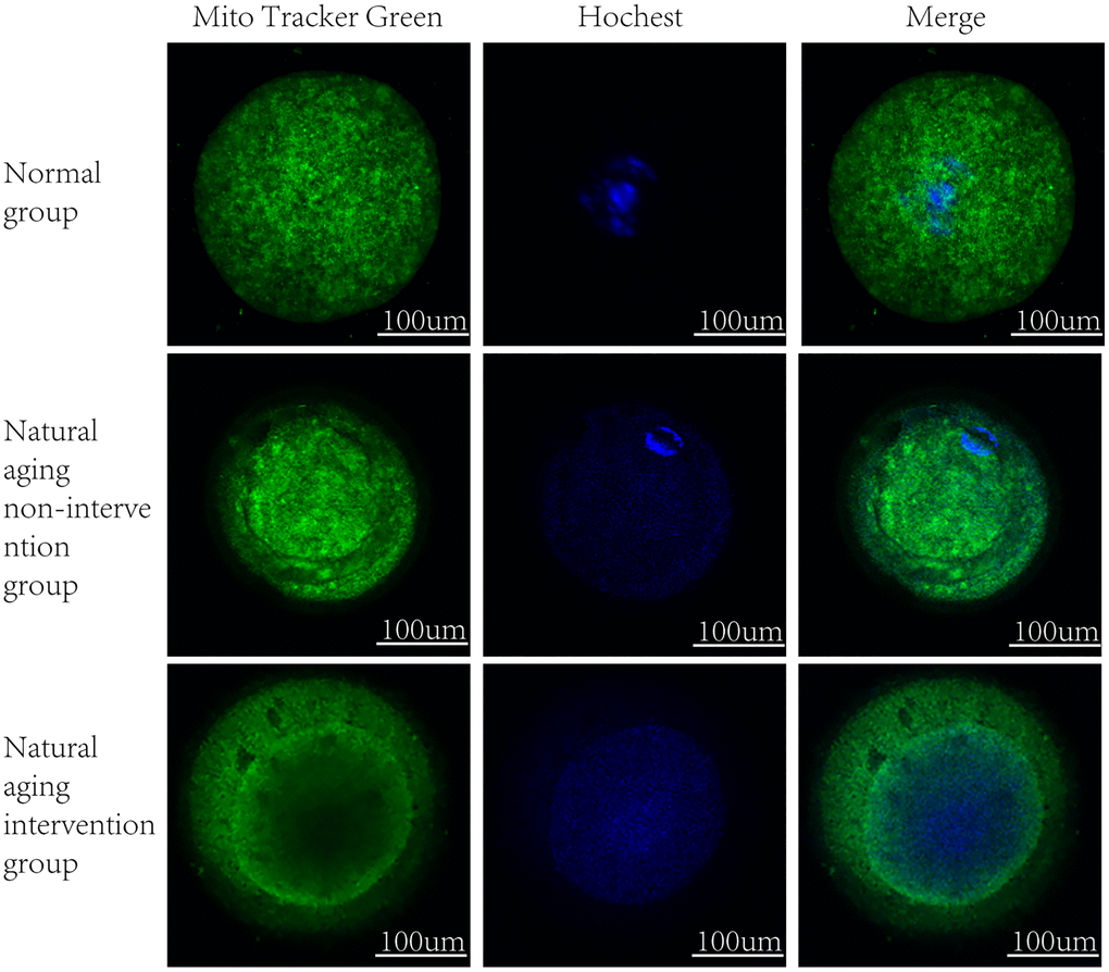 Mitochondrial distribution. MitoTracker Green staining mitochondria, Hoechst nuclear staining.