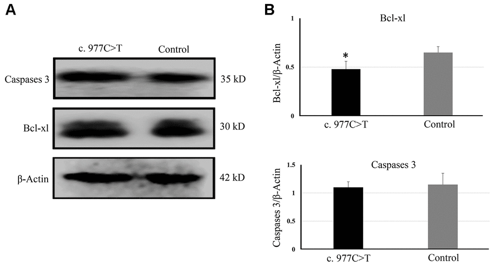 The expressions of genes related to apoptosis were determined by Western blotting (A) and quantitative analysis (B). *P 