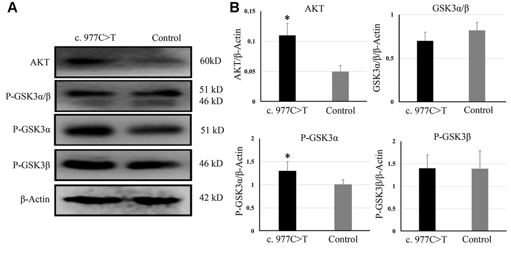 The expression of AKT, GSK3, P-GSK3α, and P-GSK3β were analyzed by Western blotting (A) and quantitative analysis (B). *P 