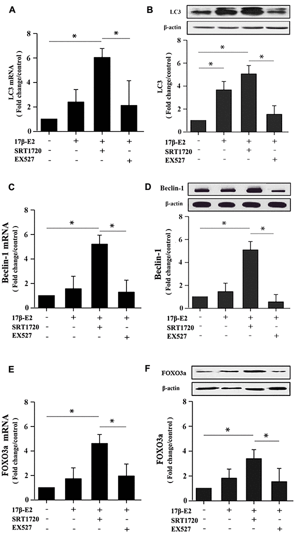 Real-time PCR and Western blotting showing the expression of LC3, Beclin-1 and FOXO3a in hFOB1.19 osteoblasts. Cells were pretreated with or without SRT1720 and EX527 for 2 h, and then cultured with 17β-E2 (10-6 M) for 24 h. RT-PCR and Western blot assay showed the expression of LC3 (A, B), Beclin-1 (C, D) and FOXO3a (E, F) mRNA and proteins in osteoblasts. The mRNA data were normalized to GAPDH. The histograms showed the relative proteins expression of LC3, Beclin-1 and FOXO3a normalized to β-actin, and the densitometry analysis of the blots were estimated by using the Image J Software. The data were expressed as the means ± SD from 3 independent experiments. Statistically significance was evaluated using the Student±s t-test. * P 