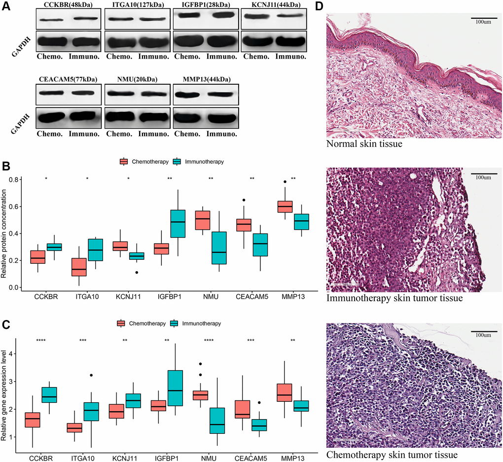 Validation of signature genes in patients with metastatic cutaneous melanoma undergoing chemotherapy and immunotherapy. (A and B) Western blot results of signature genes and t-test comparison results of gray values between the two groups. (C) T-test comparison results of the relative expression levels of signature genes in real-time qPCR between the two groups. (D) Hematoxylin-eosin (HE) staining: normal skin tissue, tumor tissues of metastatic melanoma patients receiving chemotherapy and immunotherapy. *P **P ***P ****P 