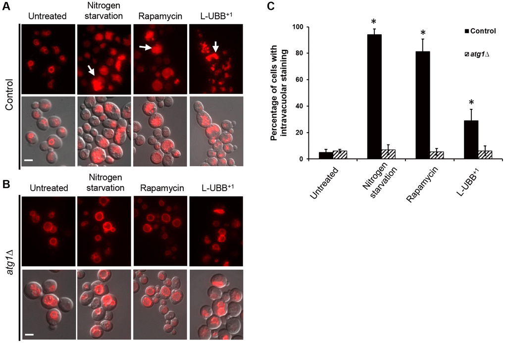 Low UBB+1 expression increases vacuolar activity. Images of vacuole staining with FM 4-64 under wild type background (A) and atg1Δ mutant background (B). Top panel: FM 4-64 fluorescence. Bottom panel: overlay of DIC and FM 4-64 fluorescence images. White arrows indicate cells with intravacuolar staining. Scale bar = 5 μm. (C) Quantification of the percentage of cells containing intravacuolar staining in the indicated strains. The data are shown as average values ± SD from three independent experiments, with more than 200 cells per experiment. The asterisk (*) indicates significant differences from the untreated control strain (p 