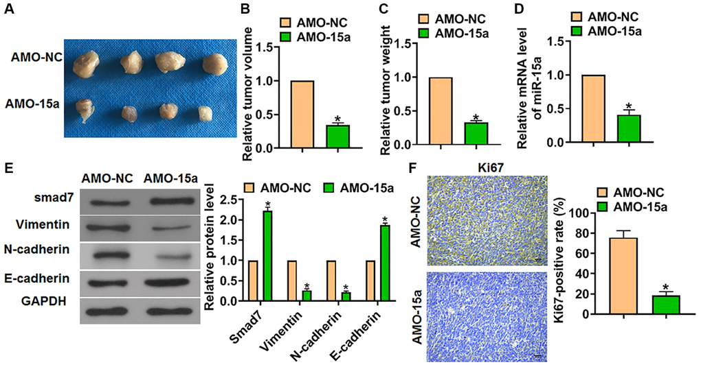 Suppressed the expression of miR-15a prevented tumorigenesis in vivo. The SHG139 cell lines stably expressing AMO-15a were inoculated into nude mice to establish glioma mouse model. (A) Representative images of separated tumors from nude mice after 30 days of inoculation. The relative tumor volume (B) and weight (C) was calculated. (D) The expression of miR-15a in tumors was tested. (E) The protein expression of Smad7 and EMT relative markers (Vimentin, N-cadherin and E-cadherin) was tested by western blot. (F) The Ki67 expression was test by IHC. Scale bar, 50 μm. Data were expressed as mean ± SD.*P 