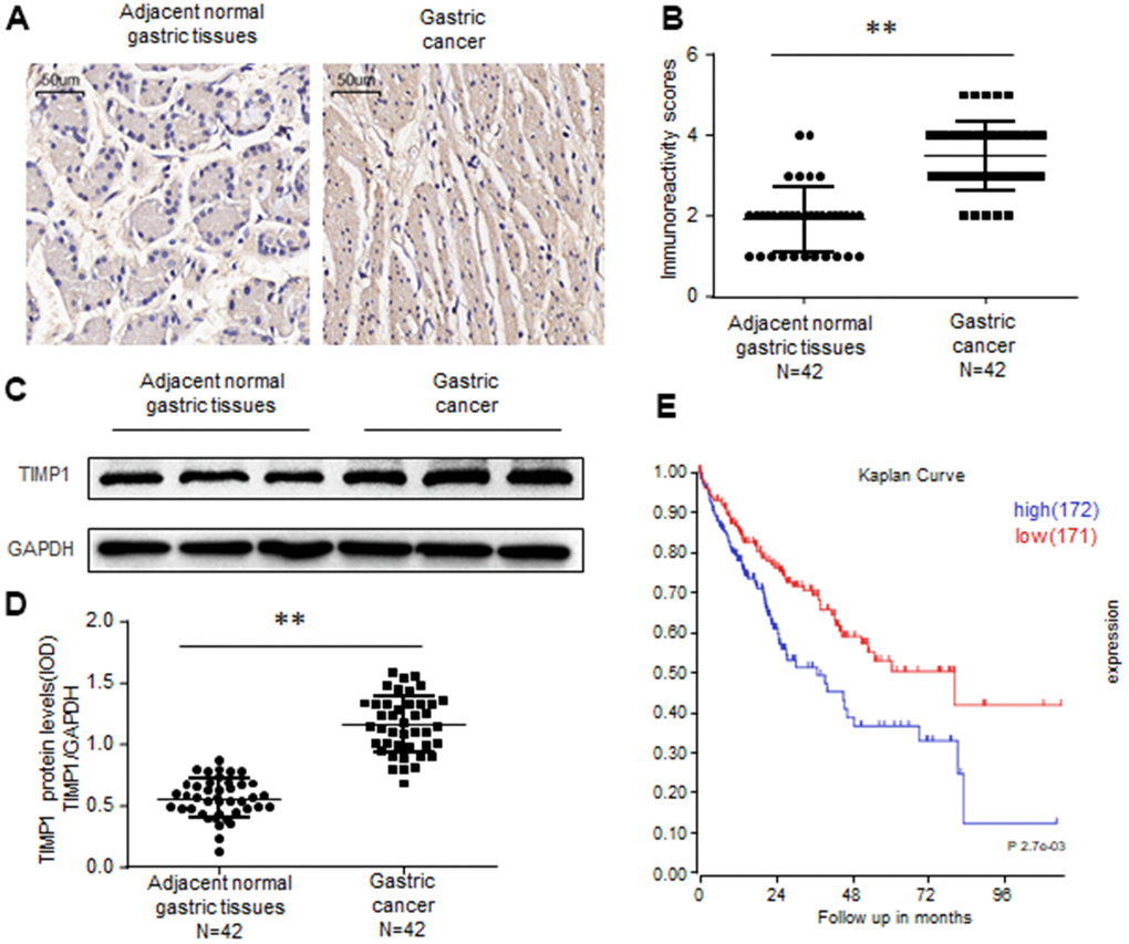 TIMP1 is upregulated in human gastric cancer. (A, B) Immunohistochemistry of TIMP1 expression in 42 gastric carcinoma tissues and 42 adjacent normal gastric tissues. Representative immunohistochemistry images (A) and semi-quantitative evaluation (B) of TIMP1protein expression. (C, D) Analysis of TIMP1 expression in 42 gastric carcinoma tissues and 42 adjacent normal gastric tissues. Representative western blotting images of TIMP1 protein levels in three normal gastric tissues and three gastric carcinoma tissues (C). TIMP1 and GAPDH protein levels were determined via densitometry using ImageJ and are represented as IOD (D). (E) Kaplan-Meier survival analyses of GC patients with high or low TIMP1 expression based on KM plotter database and GSE15459 dataset Data represent the means ± SEM. **P 