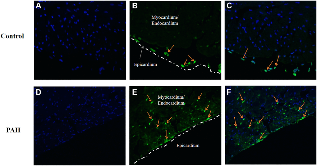 Apoptosis was increased in the PAH model mice. TUNEL staining was used to examine apoptotic cells on the heart sections of the control and PAH model mice. (A) the image of the DAPI-stained (blue staining) heart section of the control mice. (B) the image of the TUNEL-stained (green staining) heart section of the control mice. Arrow, TUNEL-stained apoptotic cell. (C) the merged image of DAPI-stained (blue staining) and TUNEL-stained (green staining) heart section of the control mice. Arrow, TUNEL-stained apoptotic cell. (D) the image of the DAPI-stained (blue staining) heart section of the PAH mice. (E) the image of the TUNEL-stained (green staining) heart section of the PAH mice. Arrow, TUNEL-stained apoptotic cell. (F) the merged image of DAPI-stained (blue staining) and TUNEL-stained (green staining) heart section of the PAH mice. Arrow, TUNEL-stained apoptotic cell.