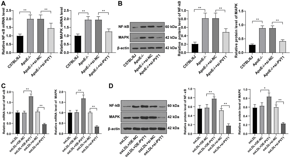 Silencing PVT1 downregulates the MAPK/NF-κB signaling pathway in oxLDL-induced HA-VSMCs and AS mice. (A) mRNA expression of MAPK and NF-κB in AS mice detected by qRT-PCR; (B) Protein levels of MAPK and NF-κB in AS mice detected by Western blot; (C) mRNA expression of MAPK and NF-κB in oxLDL-treated HA-VSMCs detected by qRT-PCR; (D) Protein levels of MAPK and NF-κB in oxLDL treated HA-VSMCs detected by Western blot. Compared to the oe-NC group, * p p p p oxLDL, oxidative low density lipoprotein; AS, atherosclerosis; HA-VSMCs, Human arterial vascular smooth muscle cells; oe, overexpression; NC, negative control.