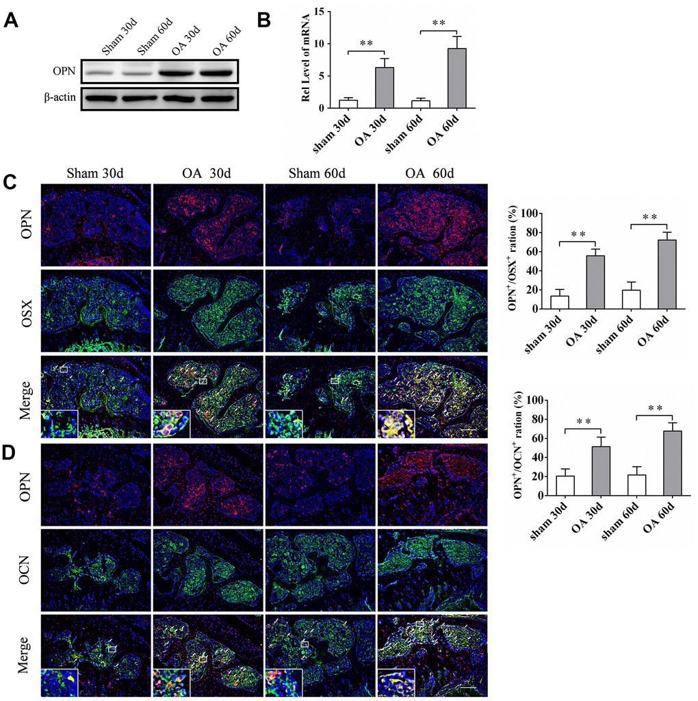 sOPN was increased expressed in OA subchondral bone mainly in preosteoblasts and osteoblasts. (A, B) Western blot and qPCR analysis of the expression of OPN in primary osteoblasts of subchondral bone of an OA mouse model and control group; n ≥ 3. (C, D) Representative immunofluorescent and quantitative analysis of sOPN in OSX+ preosteoblasts or OCN+ osteoblasts in the tibial subchondral bone of an OA mouse model and control group. Positive cells were indicated with arrows. The boxed area is magnified in the corner, scale bars = 50 μm. Data are shown as mean ± s. d. and were analyzed by Student’s t test; n = 6, *P .