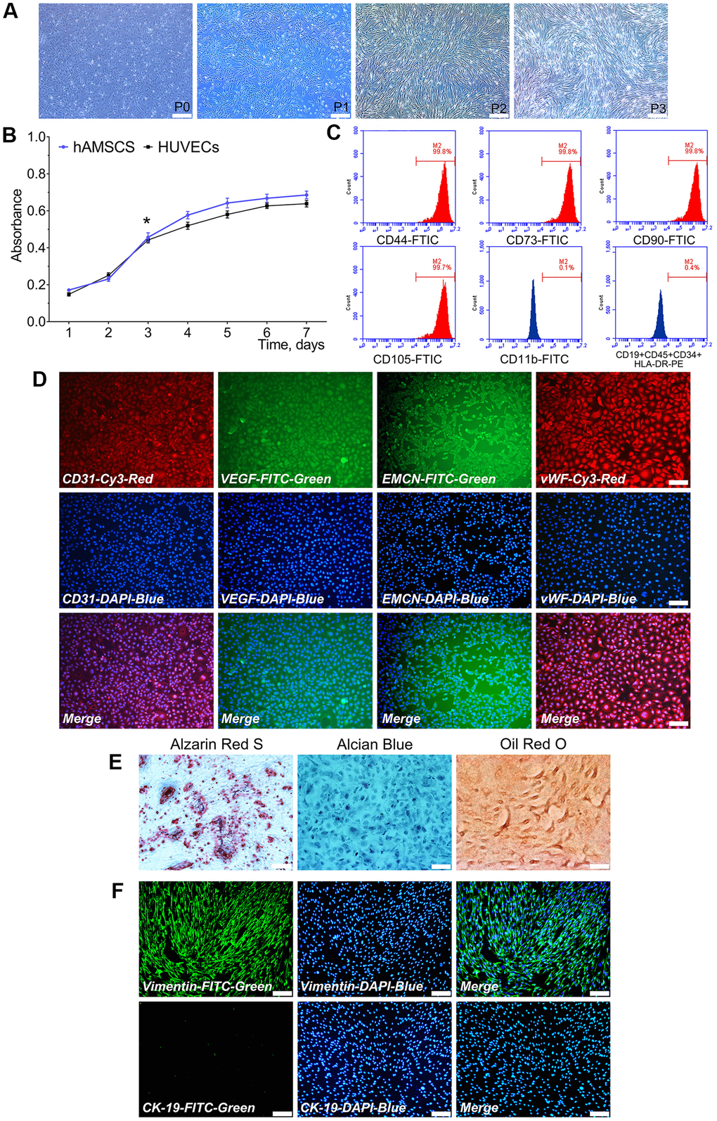 Characterization of isolated hAMSCs and HUVECs. hAMSCs at P0 to P3 showing a fibroblast-like morphology and spindle shaped configuration (×40, bar: 200 μm) (A); CCK-8 assay showed the doubling time for hAMSCs and HUVECs was 28 h and 33.5 h, respectively (*P B); Flow cytometry results showed phenotypical identities of hAMSCs at P3 (C); Phenotypic properties of HUVECs and immunofluorescence staining showed HUVECs at P3 highly expressed the surface markers of endothelial cells (×100, bar: 50 μm) (D); Multi-lineage differentiation potential of hAMSCs in vitro. Alizarin Red S staining of hAMSCs for 21 d. Alcian Blue staining of hAMSCs for 21 d. Oil Red O staining of hAMSCs for 21 d (×100, bar: 50 μm) (E); hAMSCs at P3 scarcely expressed CK-19 and highly expressed vimentin. CK-19 and vimentin were stained green by FTIC, and cell nuclei were stained blue by 4’, 6-diamidino-2-phenylindole (DAPI) (×100, bar: 50μm) (F). FITC: Fluorescein isothiocyanate; PE: Phycoerythrin.