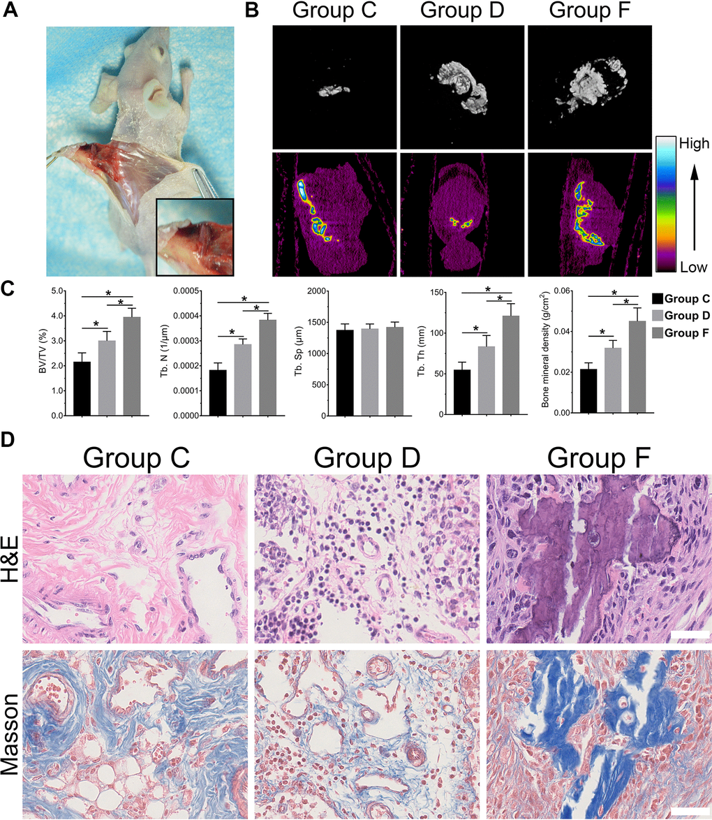 BMP9 increases subcutaneous ectopic bone formation of hAMSCs cocultured with HUVECs. Representative images of subcutaneous ectopic bone formation of nude mice (A); Subcutaneous ectopic osteogenic bone formation were detected by micro-CT scanning to investigate the 3D iso-surface and the heat map of average mineralization density at 4 weeks. In the heat map, white represents the highest average mineral density and black represents the lowest (B); Quantified analysis results of micro-CT scanning show the effect of BMP9 on cocultured hAMSCs and HUVECs induced ectopic bone formation, and the relative values of bone volume/total volume (BV/TV), trabecular bone number (Tb. N), trabecular bone separation (Tb. Sp), trabecular bone thickness (Tb.Th), and bone mineral density (BMD) were demonstrated (C); The retrieved bone masses were subjected to Trichrome-Masson staining and H&E staining to determine the formation of trabecular bone and bone matrix (×400, bar: 50μm) (D) (*P 