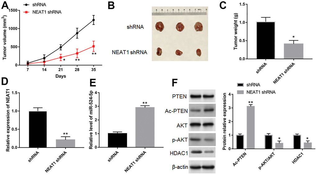 Silence of NEAT1 suppressed tumor growth in vivo. (A) Tumor growth curves in two groups. (B) Representative images of TU212 cells from nude mice. (C) The effect of NEAT1 silence on tumor weight. The expression of NEAT1 (D), miR-524-5p (E), PTEN, Ac-PTEN, AKT, p-AKT and HDAC1 (F) in tumor tissues was detected with Western blotting. * P P 