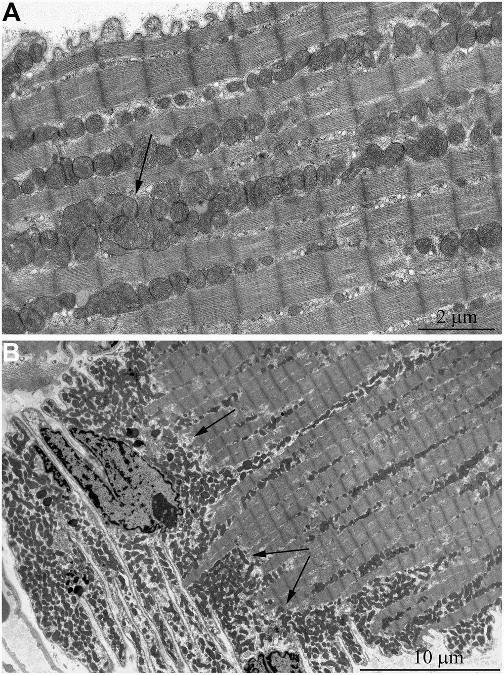 Ultrastructure of mitochondria in skeletal muscle of 5-year-old naked mole rat. (A) Longitudinal section of muscle fiber. Rows of mitochondria arranged along myofibrils can be observed, mitochondrial cluster is indicated by arrow. (B) Longitudinal section of muscle fiber. Large clusters of mitochondria in the perinuclear and subsarcolemmal areas are indicated by arrows.