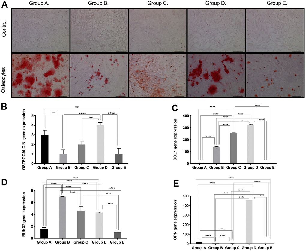 Osteogenic differentiation ability of PDMSCs from different maternal age group. (A) Representative image of Osteogenic differentiation of all 5 age groups. Upper panel showed that undifferentiated cells did not retain Alizarin staining. Lower panel showed that differentiated cells were positive to Alizarin staining. Real Time PCR performed to measure the gene expression of (B) Osteocalcin, (C) Collagen type 1 (COL1), (D) Runt-related transcription factor 2 (RUNX2), and (E) Osteopontin (OPN) of all 5 age groups. Group A: 18-21; Group B: 22-25; Group C: 26-30; Group D: 31-35; Group E: 36 and over. *, pppp