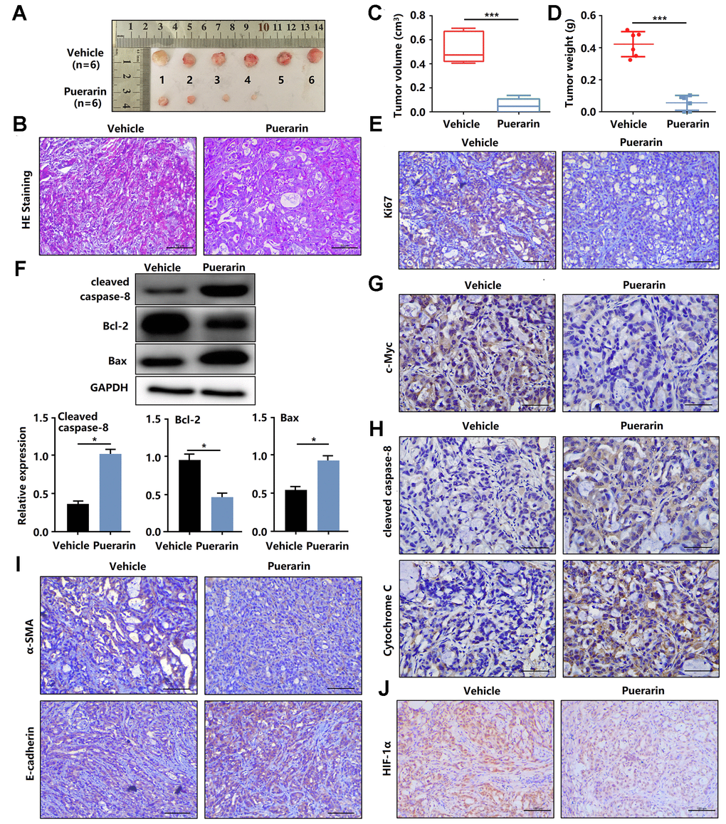 Puerarin inhibits the tumor growth and metastasis of PDAC in the animal xenograft model. (A) Effects of puerarin on morphologic changes in the experimental groups. (B) Pathological results of H&E staining for PDAC in tissues of the model group. Bar = 50 μm. (C) Effect of puerarin on the volume of tumors in the animal xenograft model. (D) Effects of puerarin on tumor weight. (E) IHC staining for Ki67 in the puerarin-treated model. Bar = 50 μm. (F) IHC staining for c-Myc in the puerarin-treated model. Bar = 50 μm. (G) Protein expression of Cleaved caspase-8, Bax and Bcl-2 in PDACs in different groups. (H) IHC staining for Cleaved caspase-8 and cytochrome C in the puerarin-treated model. Bar = 50 μm. (I) IHC staining for E-cadherin and α-SMA in the puerarin-treated model. Bar = 50 μm. (J) IHC staining for HIF-1α in the puerarin-treated model. Bar = 50 μm. The data are presented as the mean ± standard deviation, and were analyzed by a two-sided Student’s t-test. *p ***p 