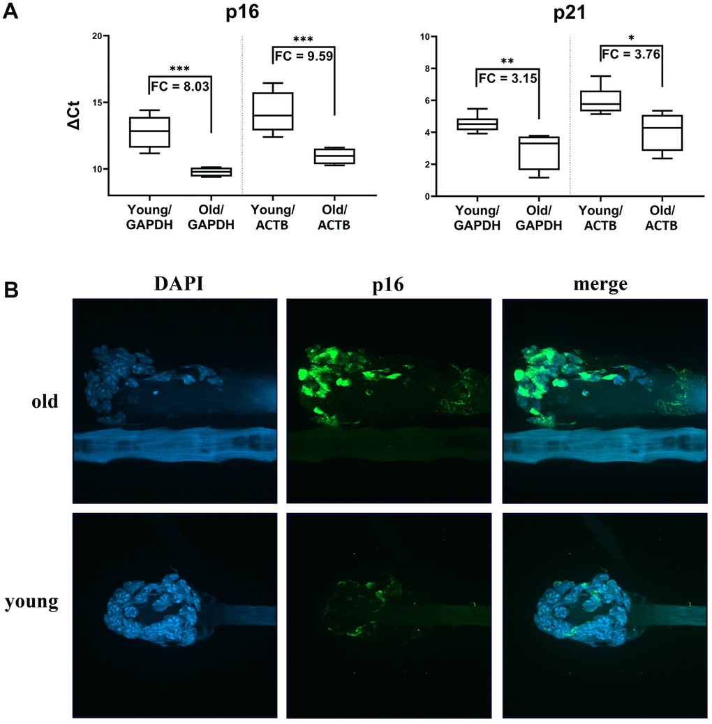 Markers of senescence analysis in hair follicular cells. (A) p16 and p21 gene expression (mRNA level) in hair follicles from young mice (6 months old) and old mice (2.5-3 years old) in boxplot graphs of ΔCt values normalized using GAPDH or ACTB. Graphs show medians, first quartile data distribution, minimal and maximal points, and fold change values as a specifying detail. Results of a t-test are also shown (*pB) Representative images showing the higher p16 protein levels in murine hair follicles of old animals relative to those of young animals. Images were obtained from z-stack scanning with a confocal spinning disc microscope. DAPI-stained nuclei are shown in the blue channel and p16 signals in the green channel. Autofluorescence can be seen in a hair shaft. Magnification 60x objective with oil immersion.