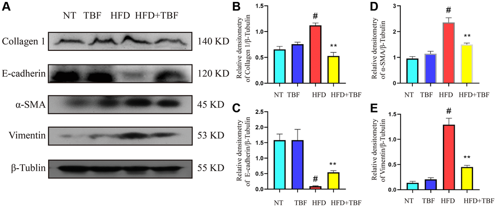 The effect of TBF on fibrosis induced by HFD during pregnancy and lactation. 1 g/L TBF was dissolved in 0.1% carboxymethylcellulose sodium solution and was ingested by mice by drinking water. Drinking water administration began on the first day of mating and stopped one week after delivery, and then mammary tissue was collected. (A) Collagen 1, E-cadherin, α-SMA, Vimentin, β-Tublin protein bands; (B) Analysis of the relative density value of Collagen 1 protein; (C) Analysis of the relative density value of E-cadherin protein; (D) Analysis of relative density value of α-SMA protein; (E) Analysis of the relative density value of vimentin protein; β-Tubulin was used as a reference for protein control. The data error was based on SEM, three independent repeated experiments were performed; #p ∗∗p 