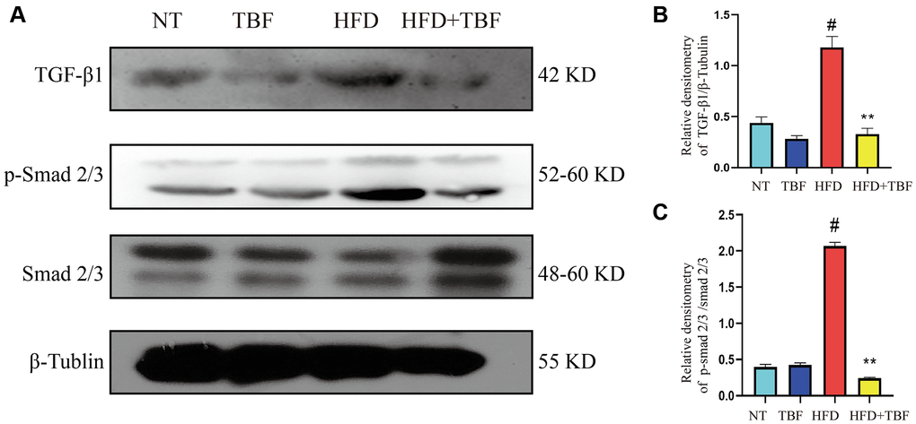 The effect of TBF on TGF-β/Smad signal induced by HFD during pregnancy and lactation. 1 g/L TBF was dissolved in 0.1% carboxymethylcellulose sodium solution and was ingested by mice by drinking water. Drinking water administration began on the first day of mating and stopped one week after delivery, and then mammary tissue was collected. (A) Protein bands of TGF-β1, p-Smad2/3, Smad2/3, β-Tubulin; (B) Analysis of the relative density value of TGF-β1 protein; (C) Analysis of relative density value of p-Smad2/3 protein; β-Tublin was used as a reference of TBF-β1, Smad2/3 was used as a reference of p-Smad2/3. The data error was based on SEM, three independent repeated experiments were performed; #p ∗∗p 